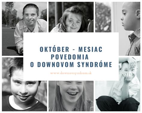 Základné fakty o Downovom syndróme