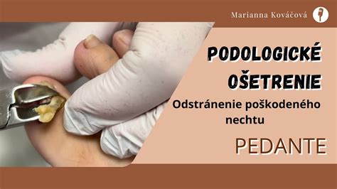 Porovnanie zdravého a poškodeného nechtu v dôsledku onychofágie