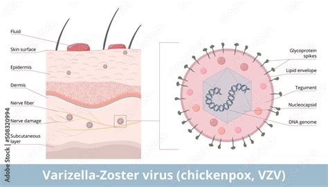 Vírus varicella zoster v nervových gangliách