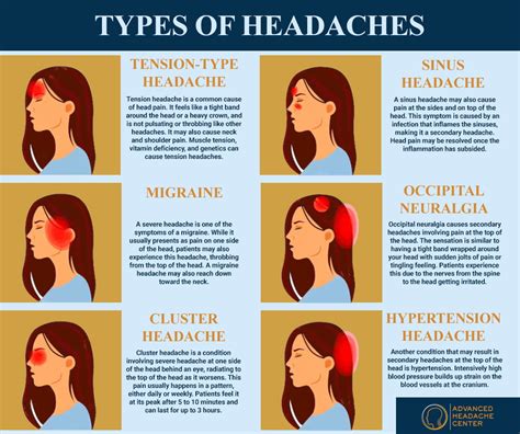 Causes of headaches infographic