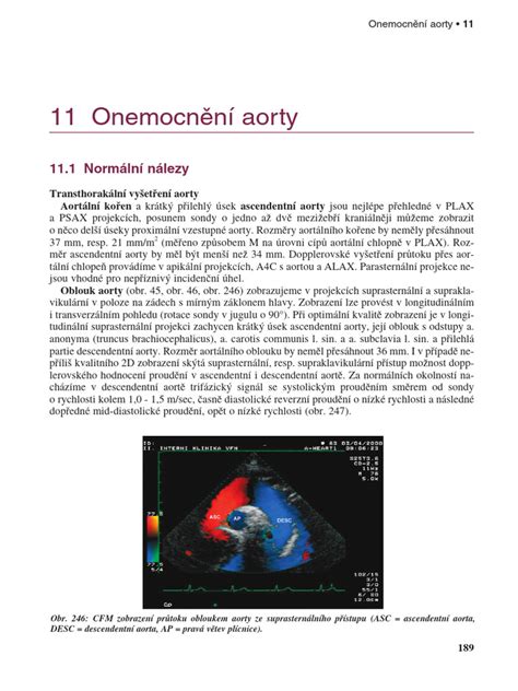 Zobrazovanie aorty pomocou echokardiografie