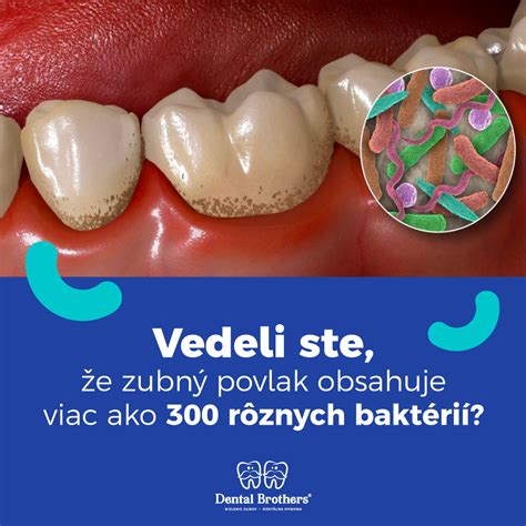 Zubný povlak a vznik zubného kameňa