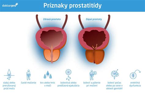 Infografika o faktoroch ovplyvňujúcich mužskú plodnosť