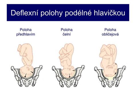 Porovnanie polohy dospelého a plodu hlavou nadol
