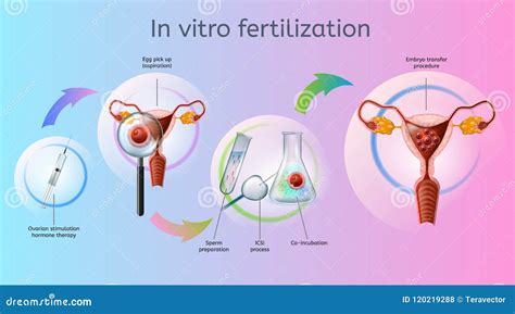 Schéma úvodných vyšetrení pred IVF