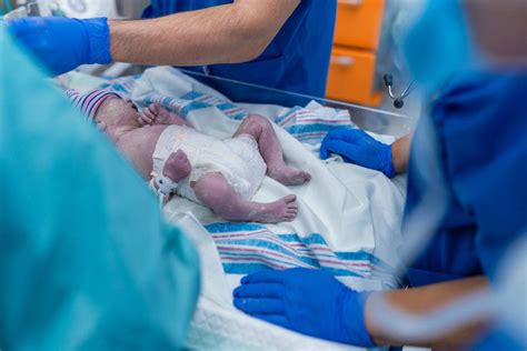 Chirurgický tím počas cisárskeho rezu