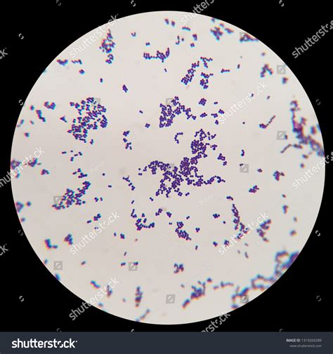 Microscopic view of streptococcus bacteria