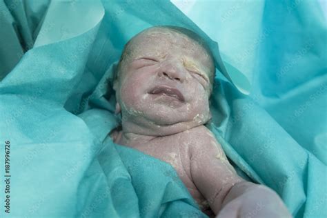 Novorodenec pokrytý vernix caseosa