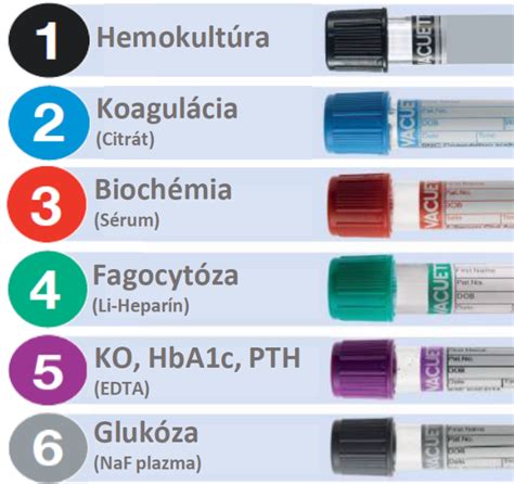 Odber krvi v laboratóriu