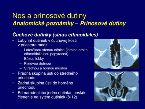 Schéma zapálených prínosových dutín