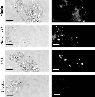 Microscopic view of saliva patterns during different cycle phases