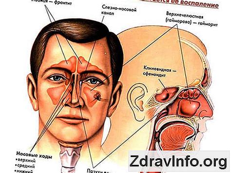 Schéma anatómie nosových dutín u malého dieťaťa