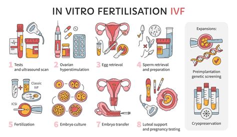 Schéma krokov procesu in vitro fertilizácie (IVF)