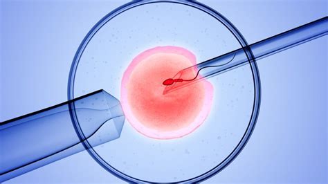 Základný princíp in vitro fertilizácie (IVF)