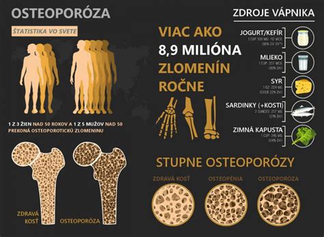 Infografika: Stupne inkontinencie a úhrady poisťovňou