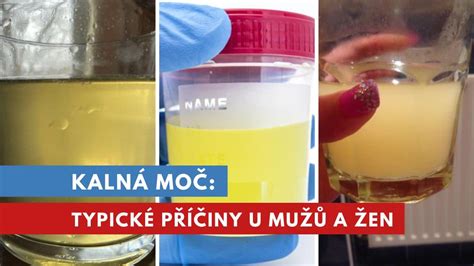 Zmesi moču s rôznymi prísadami pre domáce testy (cukor, soľ, sóda)