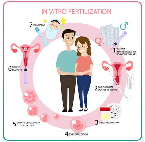 Infografika znázorňujúca priebeh IVF cyklu