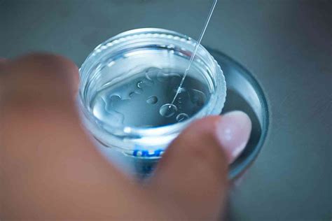 ICSI metóda oplodnenia