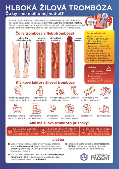 Infografika znázorňujúca šikanu a jej prejavy