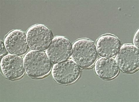 Mikroskopický snímok améby