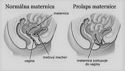 Diagram panvových orgánov v tehotenstve