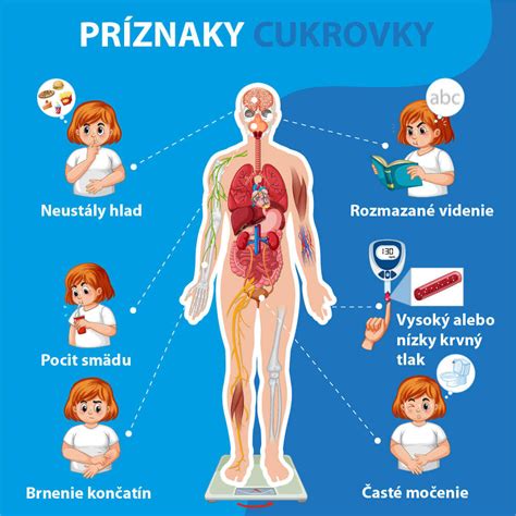 Infografika znázorňujúca príznaky a mechanizmus vzniku OHSS