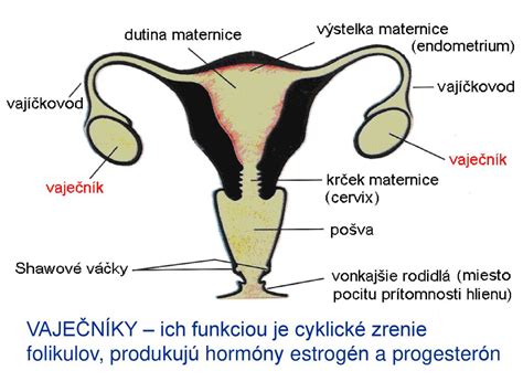 Schéma vrodených anomálií maternice