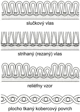 Schematické znázornenie rôznych typov leiomyómov podľa ich lokalizácie v stene maternice