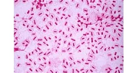 Baktéria Haemophilus influenzae pod mikroskopom