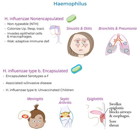 Diagram znázorňujúci rôzne časti tela, ktoré môže postihnúť Haemophilus influenzae