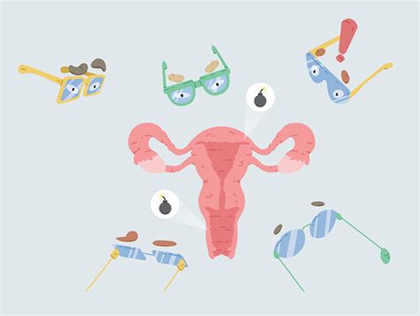 Ilustrácia gynekologických nástrojov používaných pri kyretáži