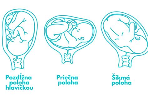 Diagram zobrazujúci proces uhniezdenia blastocysty v maternici