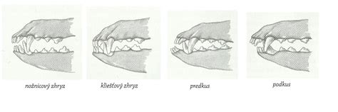 diagram porovnávajúci zdravý zhryz a zhryz ovplyvnený cumlíkom