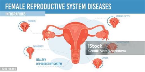Infografika zobrazujúca mužské a ženské reprodukčné systémy