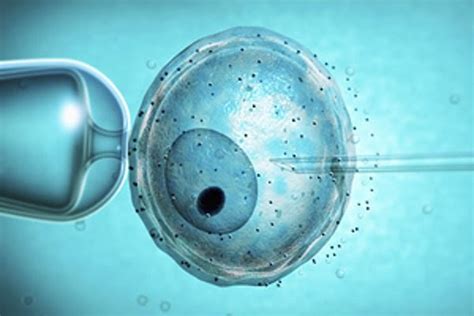 Asistovaná reprodukcia - IVF