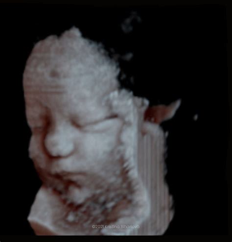 Fotografia MUDr. Kristíny Bihariovej