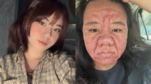 Ilustrácia ženského obehového systému počas tehotenstva