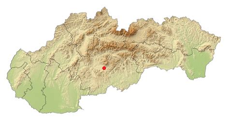 mapa Slovenska s vyznačenými miestami poskytujúcimi 3D/4D ultrazvuk