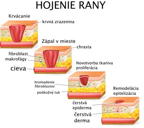 Ilustrácia znázorňujúca proces hojenia a posilňovania imunity
