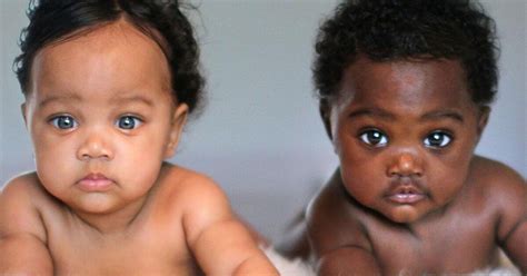 Novorodenec s neobvyklou farbou pleti