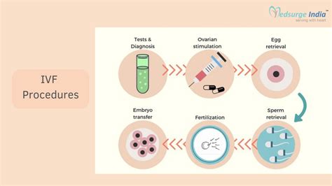 Schéma procesu mimotelového oplodnenia (IVF)