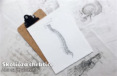 Schéma chrbtice so skoliózou