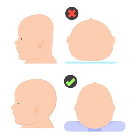 Typy zležanej hlavičky - plagiocefália vs. brachycefália