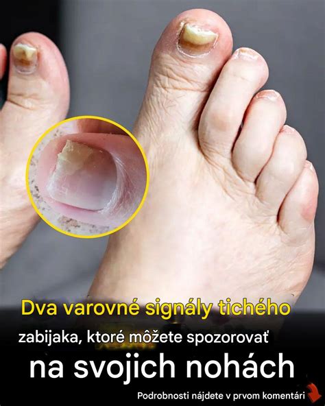 Kedy navštíviť detského lekára kvôli vyrážke