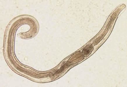 Mrľa detská - Enterobius vermicularis