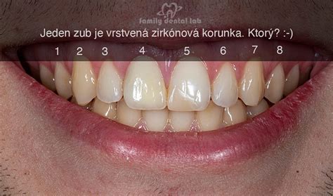Rozdiel medzi bolesťou pri ovulácii a inými príčinami