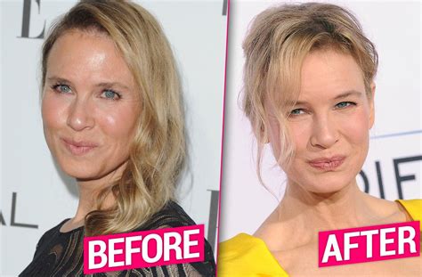 Renée Zellweger transformation