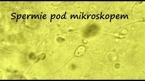 Spermie pod mikroskopom