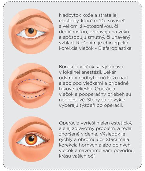 Infografika príznakov očných problémov