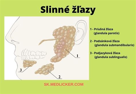 Schematické znázornenie šírenia rakoviny semenníkov lymfatickými cestami.